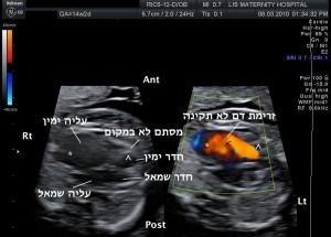 EBA final 1 לבלוג