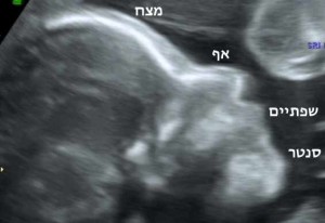 פרופיל עם הסבר בעברית רשת